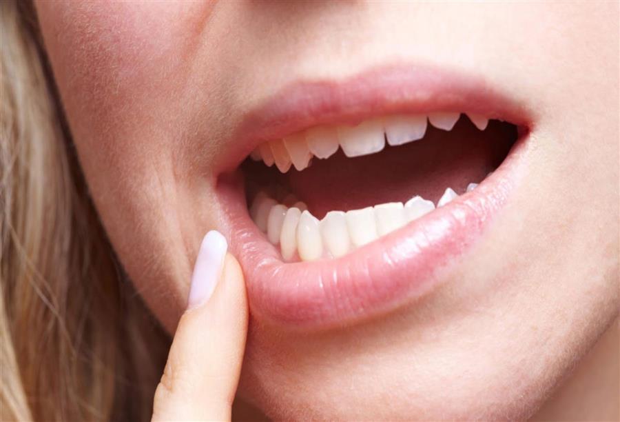 مشكلة بروز الأسنان .. أسبابها وطرق علاجها