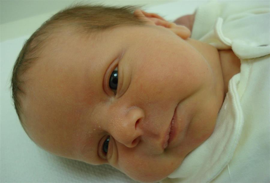 الدليل الكامل لعلاج أعراض الصفرة «اليرقان» عند الأطفال حديثي الولادة