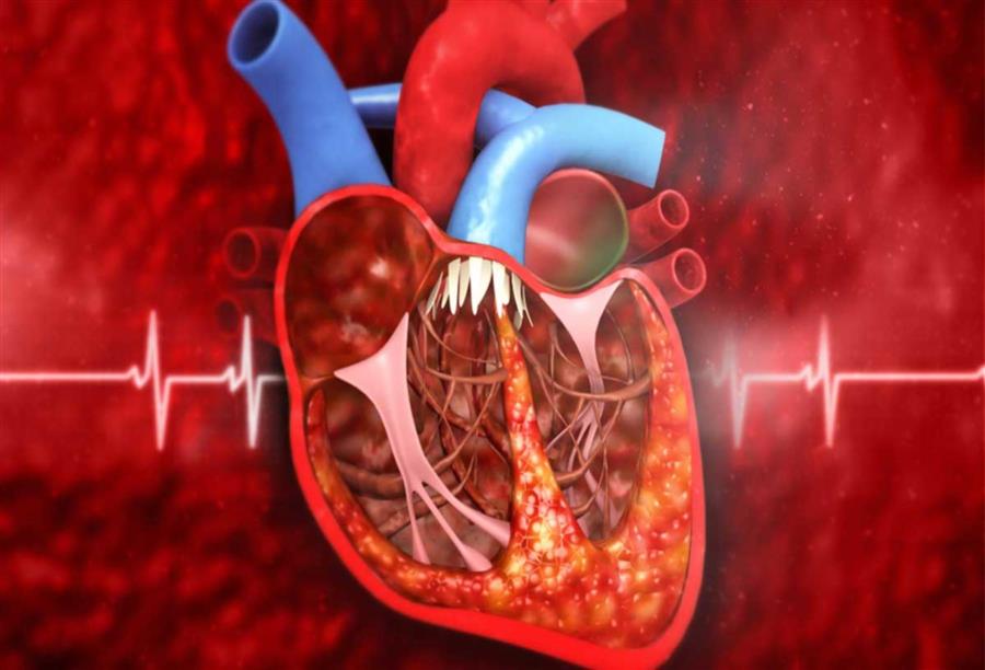 هل تزيد دعامات شرايين القلب من مخاطر العمليات الجراحية الأخرى؟