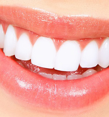  تقنيات حديثة لتجميل الأسنان .. من أجل ابتسامة جذابة