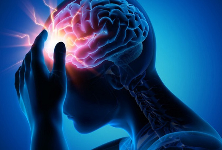 7 أعراض للسكتة الدماغية لا يجب تجاهلها
