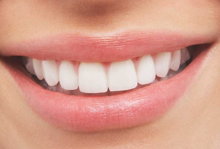 الأسنان تتنبأ بالمخاطر الصحية التي تنتظر صاحبها