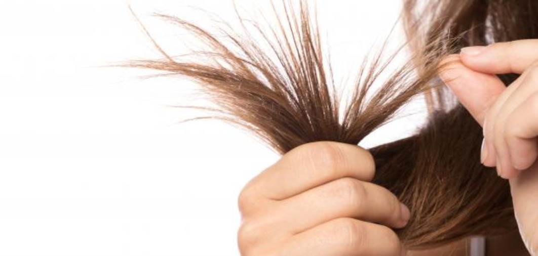 تعرفي على أسباب تقصف الشعر.. وكيف يمكنك الوقاية منه؟