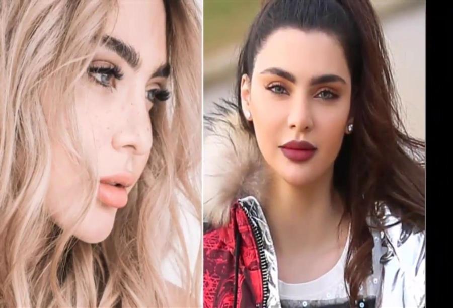 صور الفنانة قمر قبل عملية التجميل