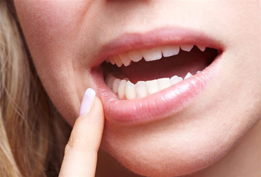 الدليل الكامل لأمراض الفم وعلاجاتها