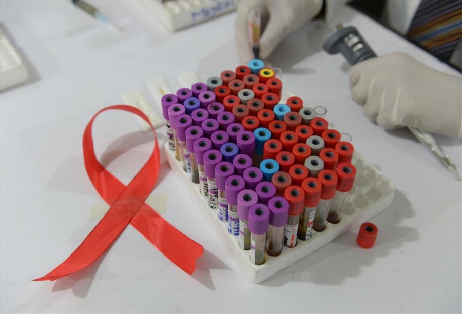عدد البروتينات الضالعة في الإصابة بفيروس الإيدز 