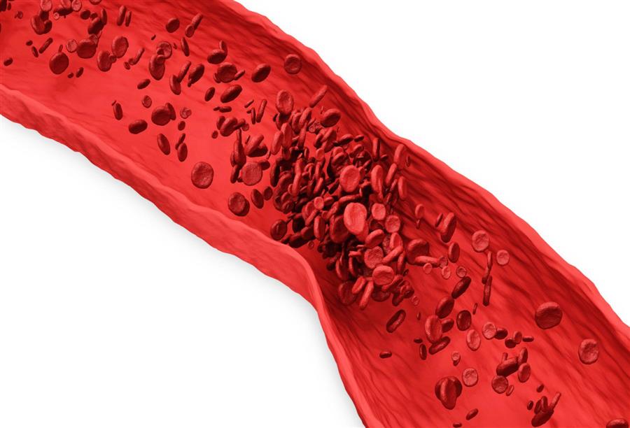اكتشف العلماء الية جزيئية تعد عاملا اساسيا في تنظيم تجلط الدم