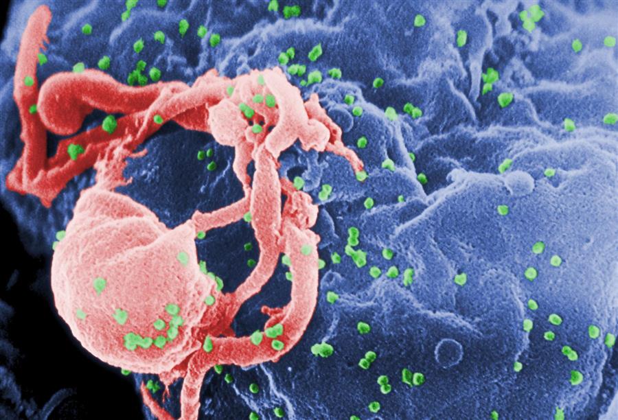العلماء الأمريكيون يتوصلون الي فك الشفرة الوراثية لفيروس الإيدز 