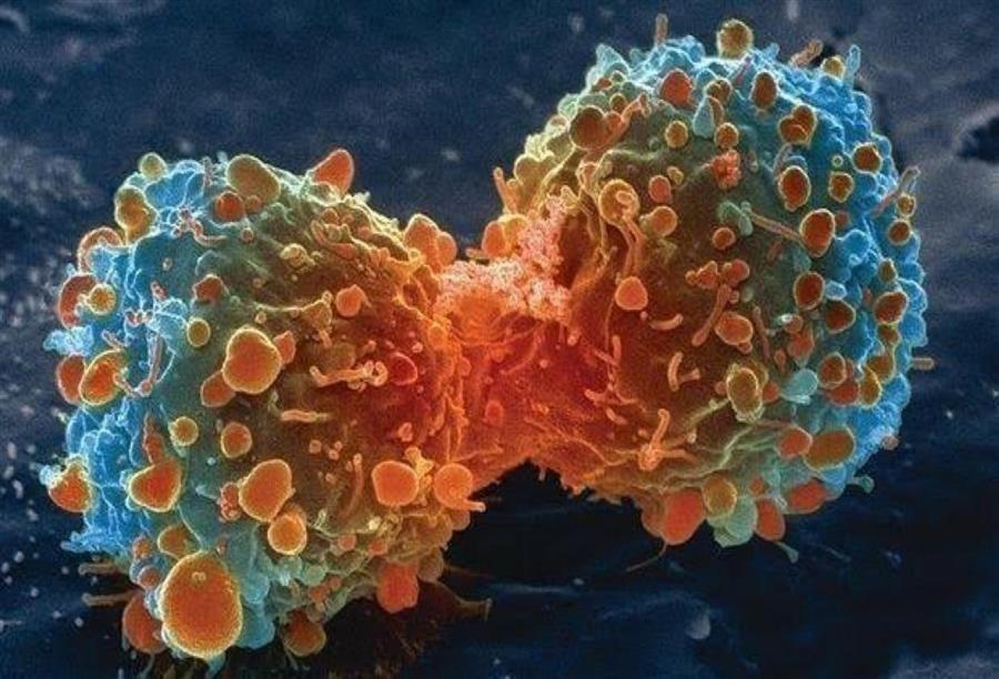 عالم مصري : جزيئات الذهب النانوية تقضي على الخلايا السرطانية دون جراحة