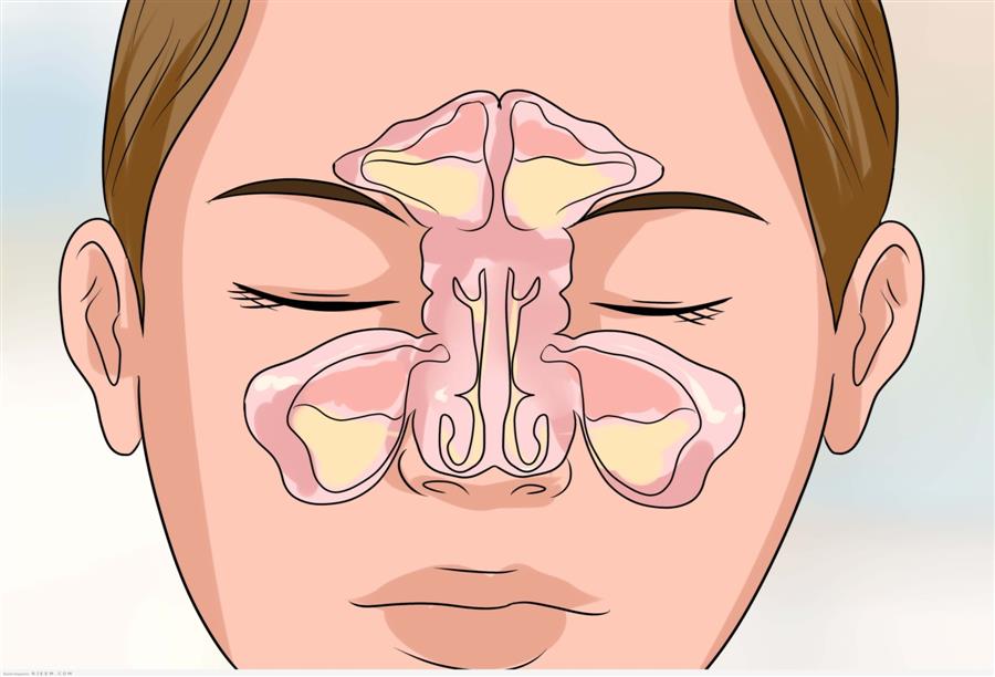 الجيوب الأنفية .. دورها عظيم في حماية الجسم وحدة حاسة الشم