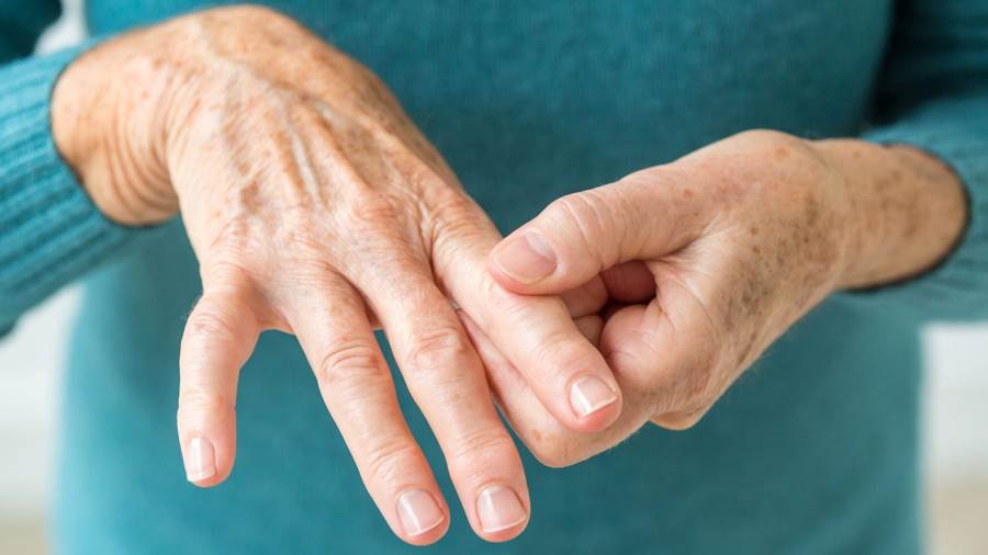 أمراض اليد الروماتيزمية .. قد تؤدي الى التشوهات والإعاقة