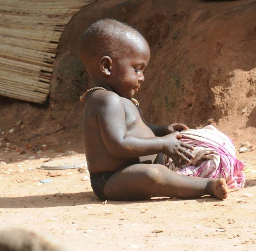 مرض غامض يصيب أطفال أوغندا .. والخبراء يبحثون عن السبب
