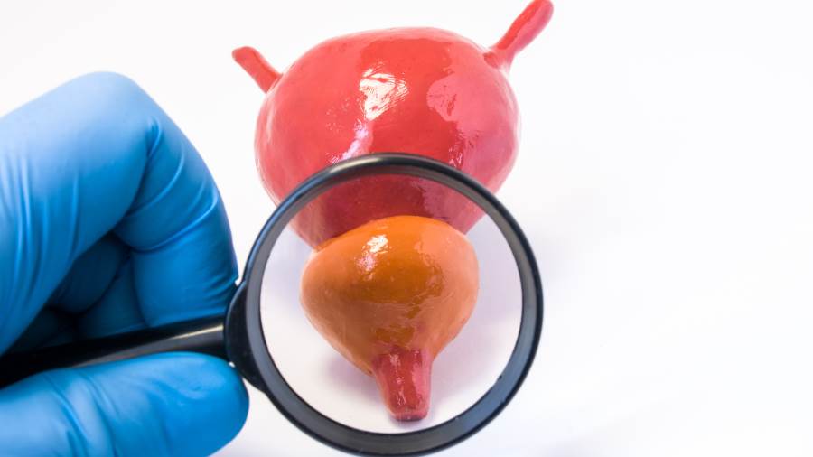 يمكن أن يؤثرالتهاب غدة البروستاتة على الحياة اليومية لكثير من الرجال في العمل والعلاقات الجنسية والقدرة على التركي