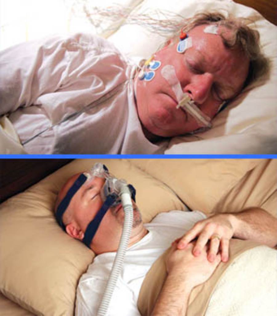 خيارات جديدة لعلاج مشكلات انقطاع التنفس أثناء النوم