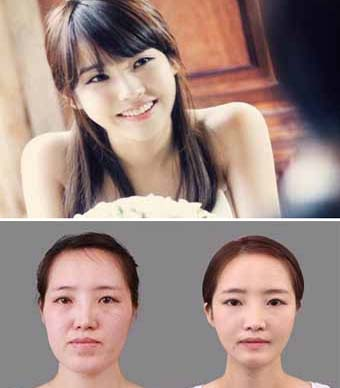من أجل الزواج والعمل .. فتيات كوريا الجنوبية مهووسات بجراحات التجميل