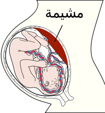 المشيمة .. العلماء يبحثون في أسرارها المؤثرة على صحة الطفل والأم