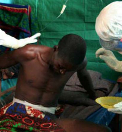 غينيا تبدأ بتنفيذ اللقاح التجريبي ضد إيبولا 