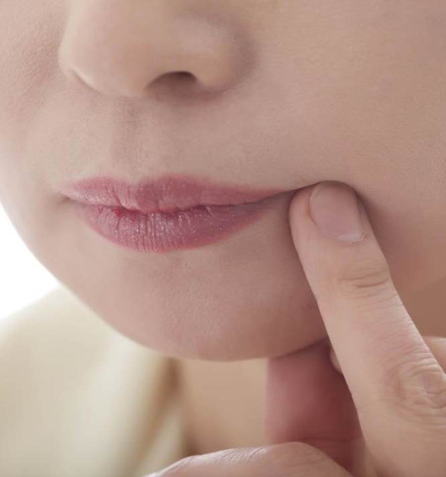 أعاني من سواد حول الفم وقد راجعت اطباء وحتى لو التزم بالعلاج يتحسن وبعد ترك العلاج يرجع كما هوة مع خوفي من ان العلاج يسبب لي لا سامح الله العقم في المستقبل مع الحل؟ وهل لهذه الحالة عمر معين وتنتهي وما