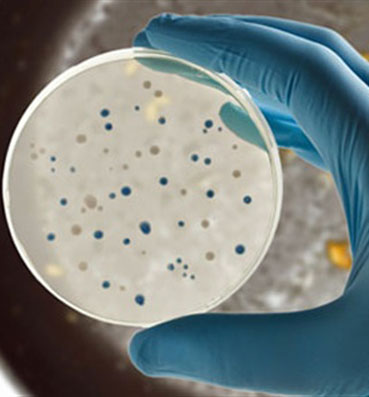 كيف تتخلصين من 10 ملايين بكتيريا في مطبخك؟