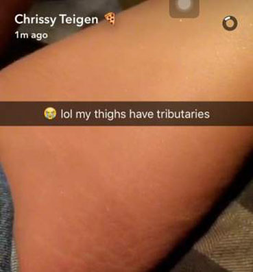 كريسي تايجن منزعجة من تشققات فخذيها بعد الولادة