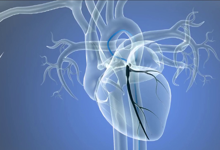 طبيب أمراض قلب ينتقد نصيحة منظمة الصحة العالمية باستبدال الزبدة بالزيت
