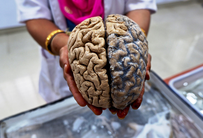 أستاذ تغذية يوضِّح المصادر الصحية لـ "وقود المخ"