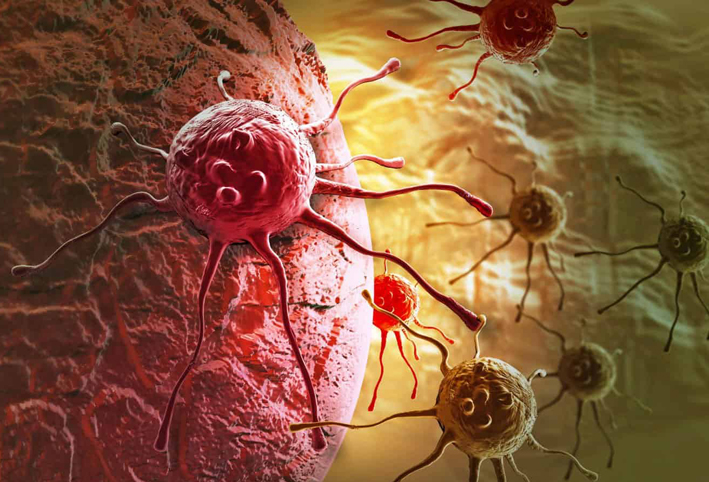علماء يكتشفون مفتاح انتشار سرطان البنكرياس