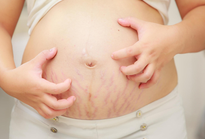 لماذا تزداد حكة الجلد أثناء الحمل؟