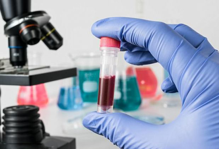اختبار دم جديد يكشف عن أكثر من 20 نوعا من السرطان بنسبة 99.4%