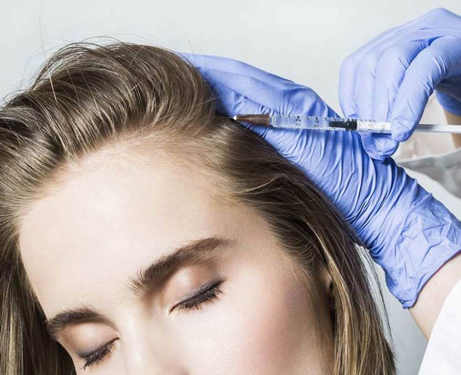 كيف تضمن نجاح عملية زراعة الشعر