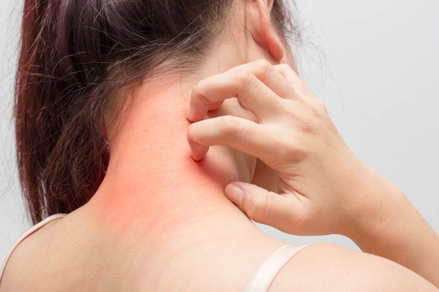 ماهي علامات سرطان الجلد أعراضه وأماكن ظهوره؟