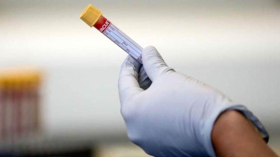 الهند تحصل على اللقاح الأول ضد كورونا بحلول نوفمبر المقبل