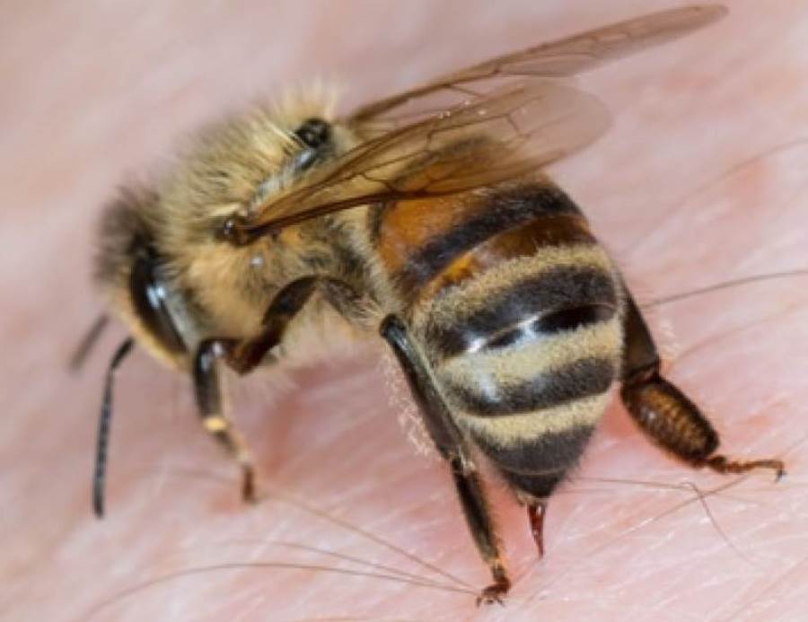 تخلصي من التهيج المؤلم للسعة النحلة بهذه العلاجات المنزلية السهلة