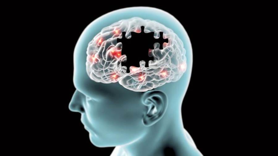 مرض ألزهايمر