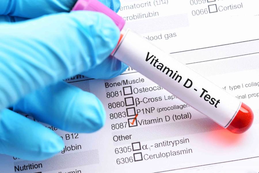 دراسة تكشف علاقة فيتامين D والاصابة بفيروس كورونا
