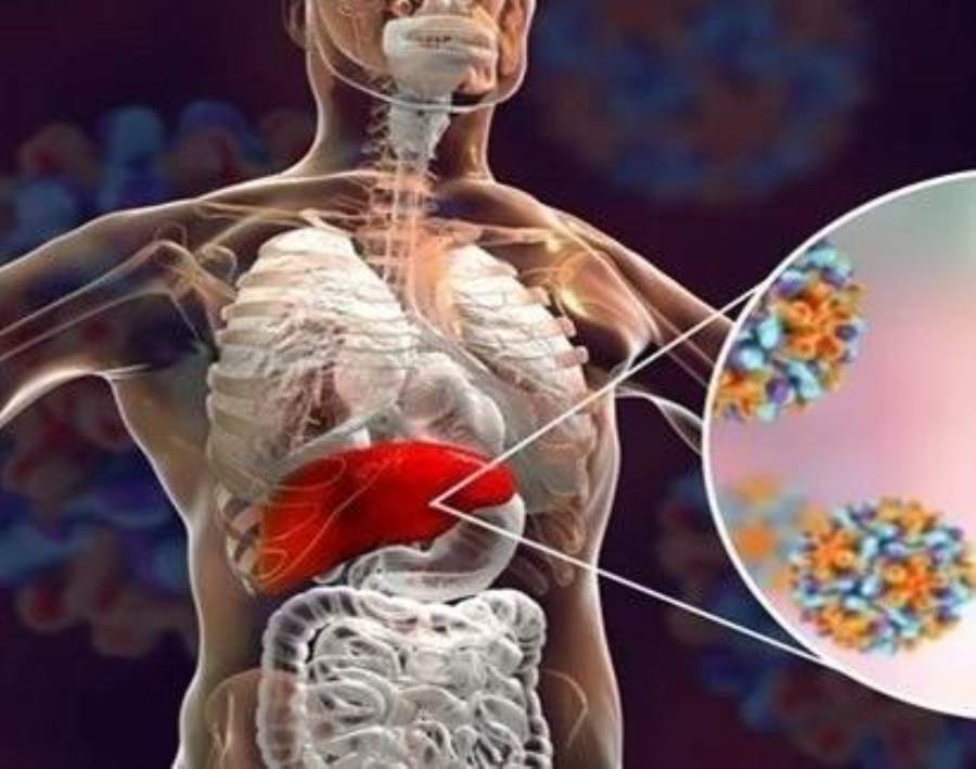 هل يؤثر فيروس كورونا على صحة الكبد؟