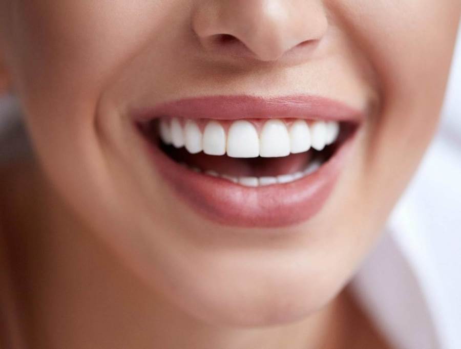 5 طرق طبيعية لتبييض أسنانك فى لمح البصر