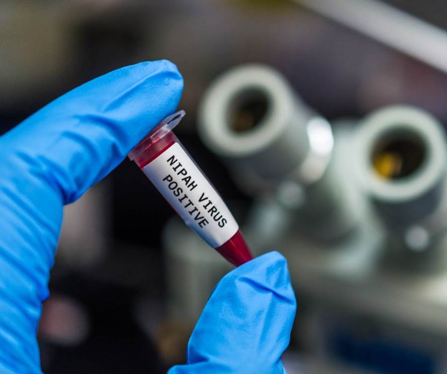 التوصل للقاح جديد لفيروس نيباه المنتشر فى الهند