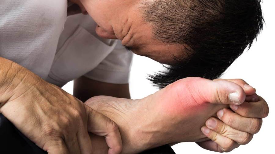 علاج النقرس
