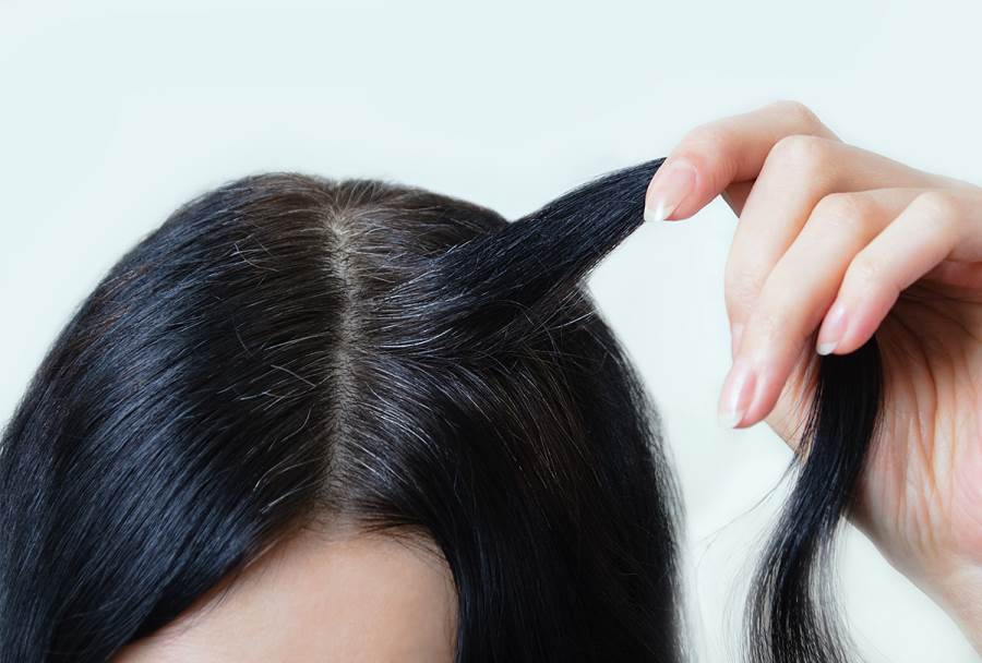العوامل الوراثية ونقص المغذيات.. أبرز أسباب شيب الشعر المبكر