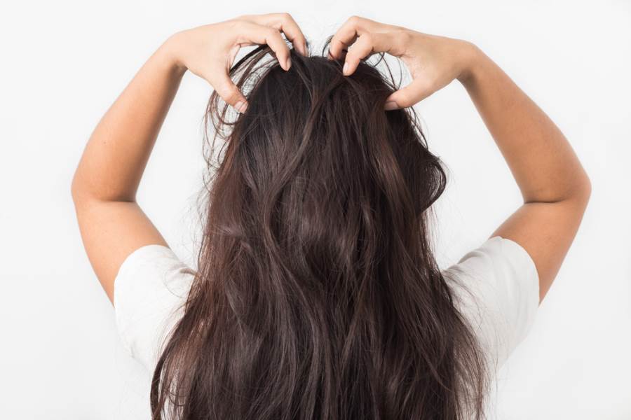 5 علاجات منزلية للتخلص من حكة فروة الرأس