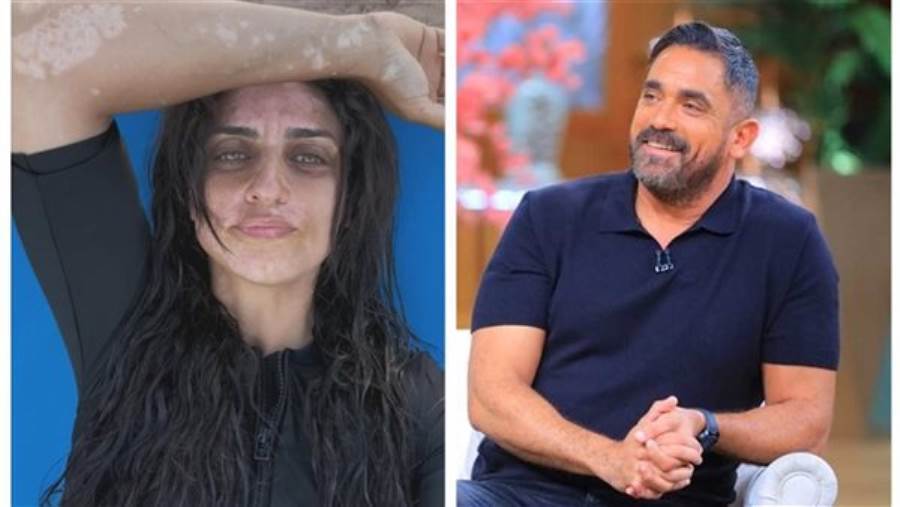 أمير كرارة يدعم أخته نسرين في رحلتها مع مرض البهاق