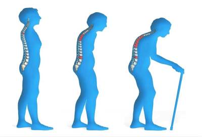 عقاقير علاج هشاشة العظم وسلامة الفك .. مالها وما عليها