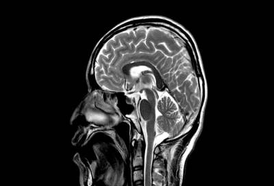 تقنية جديدة لتصوير المخ قد تمكن المرء من رؤية أحلام الأخرين