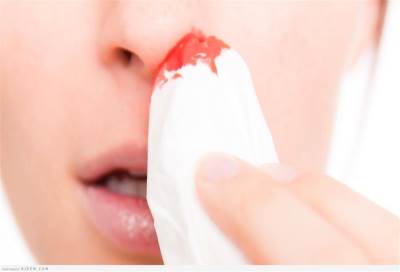 فكري في أسباب نزيف الأنف .. قبل البحث عن علاج