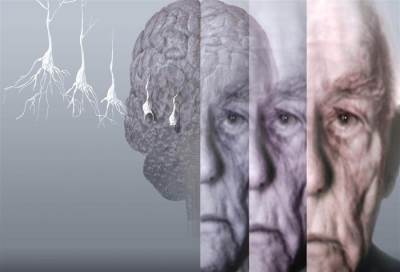 مرض الزهايمر ... العوامل المسببة وأساليب العناية