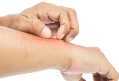 فرط الحساسية .. نتائجها مدمرة وتتطلب علاجا فوريا لوقف مضاعفاتها القاتلة