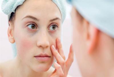 مرض الذئبة .. ملخص أنواع وأسباب هذا المرض