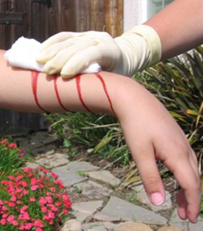 تجارب تحقق نجاحا على عقار جديد لعلاج نزف الدم