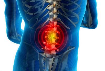 غلاف فقرات الظهر الرقيق .. السبب في كسور العمود الفقري